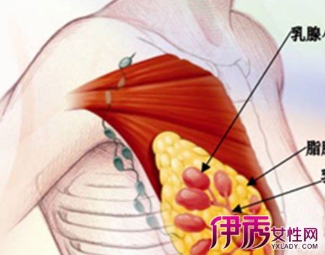 先检查乳房外观,看皮肤有无橘皮样皱缩和酒窝状改变,乳头是否内陷