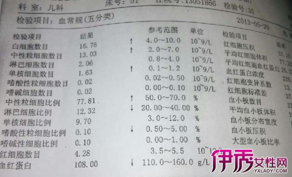 【图】单核细胞百分比偏低的原因是什么 会有哪些影响呢?