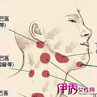 图 下巴淋巴结疼的原因分析教你如何防止疾病 下巴淋巴结疼 伊秀健康网 Yxlady Com