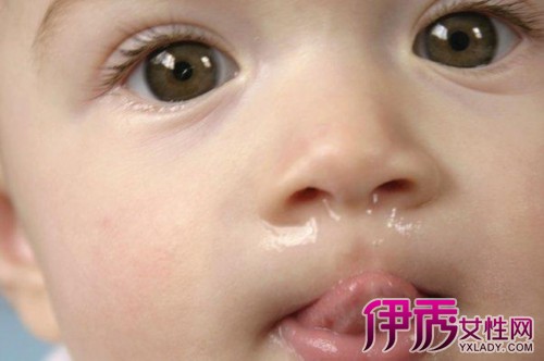 【图】4个快速治流鼻涕小妙招 从鼻涕状态看宝