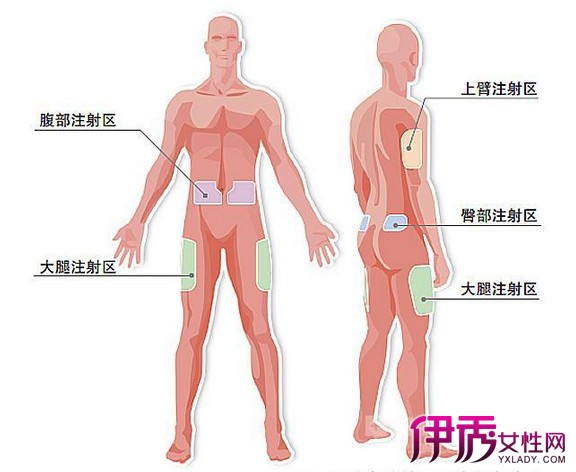 图 胰岛素注射方法皮下注射展示皮下注射胰岛素的注意事项 胰岛素注射方法皮下 伊秀健康网 Yxlady Com