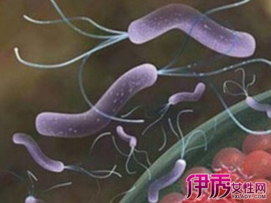 菌大便有什么症状呢 告诉你得了幽门螺杆菌怎
