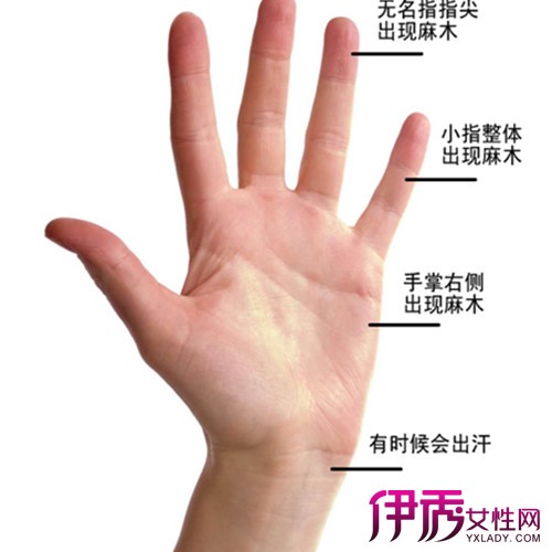 左手麻木的原因很多,其中最主要的有以下4种:上肢神